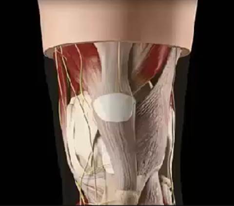 Ligamento Cruzado Anterior